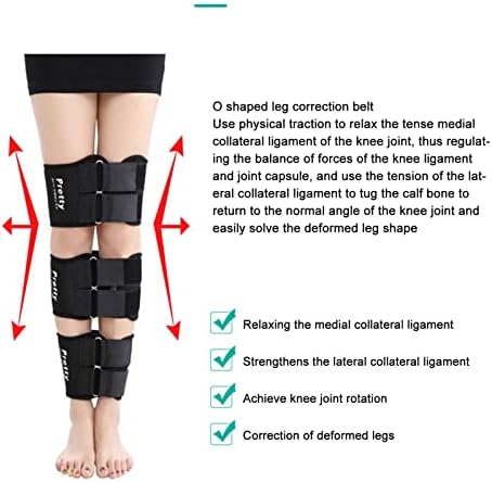 3 Adet Bacak Düzeltme Kemeri, Şekillendirme Doğrultma Sıkı Bacaklar duruş düzeltici Ped, Streç Pamuklu Malzeme, X Tipi Bacaklar,